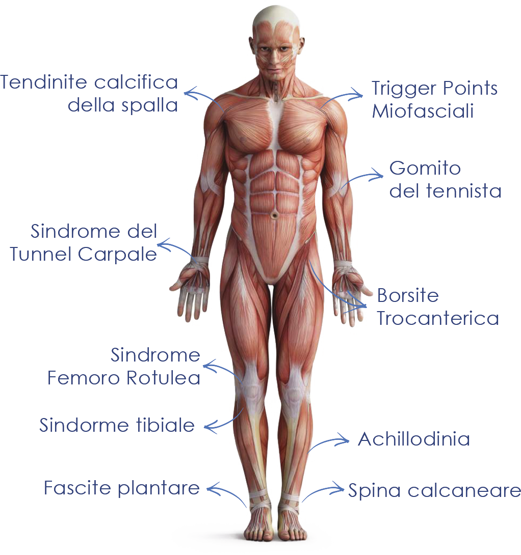 Senza-titolo-8